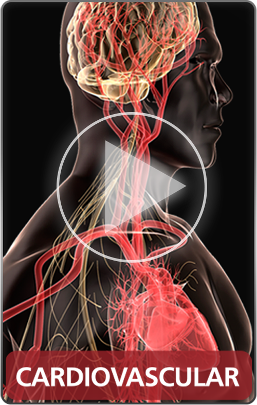 Cardiovascular - Disease Movie